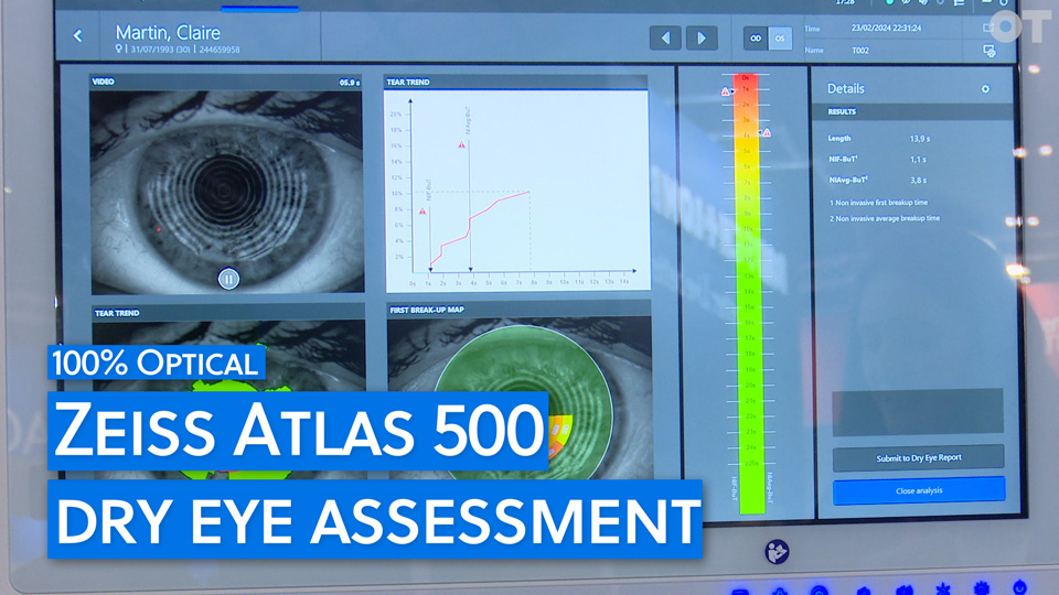 A screenshot from a YouTube video demonstration of the Zeiss Atlas 500, showing a display of three images of Claire Martin’s eye. Overlaid is the title of the video: 100% Optical Zeiss Atlas 500 Dry Eye Assement 