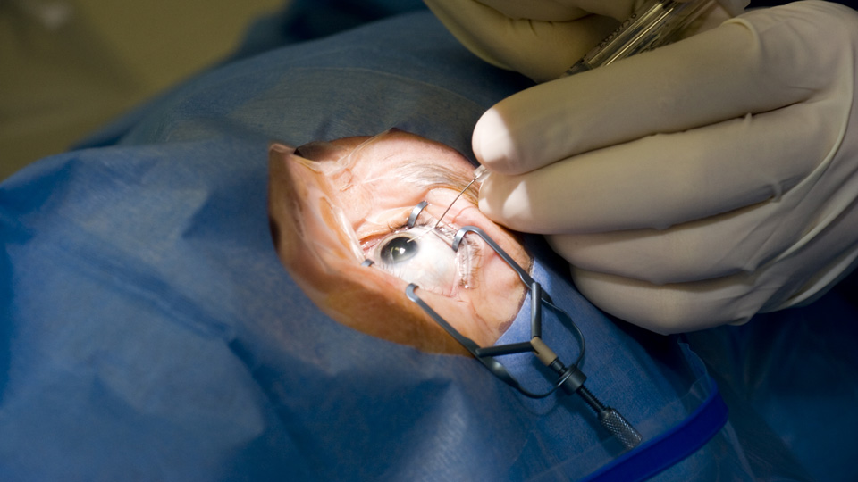 Close-up of surgeon’s hands performing manual eye surgery 