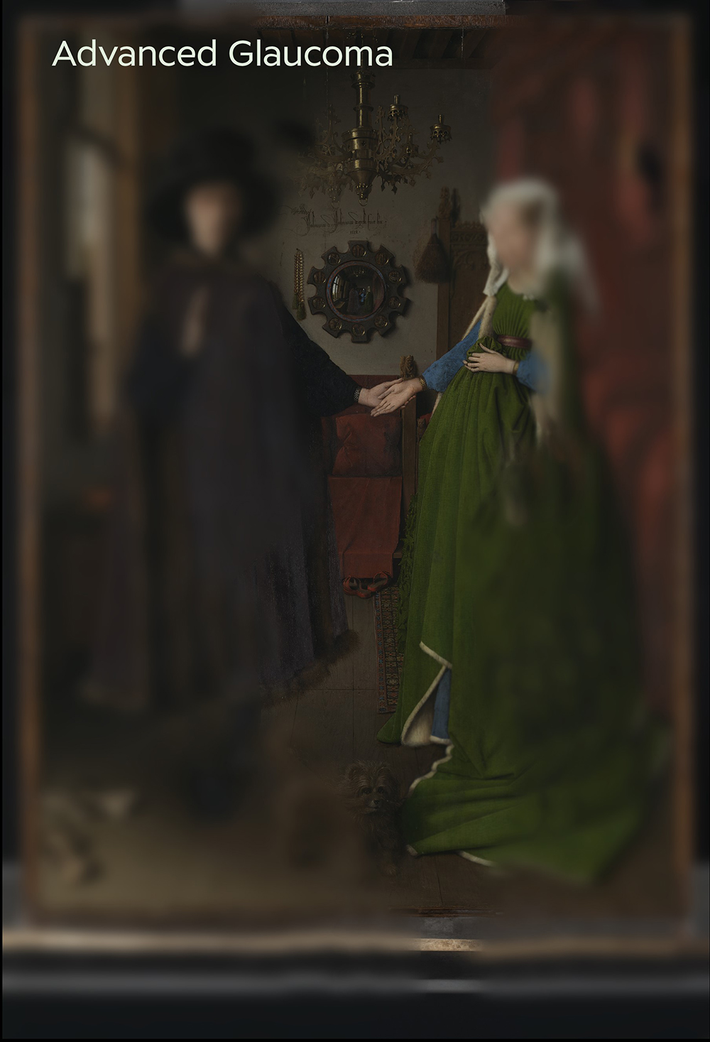 Jan van Eyck The Arnolfini Portrait advanced