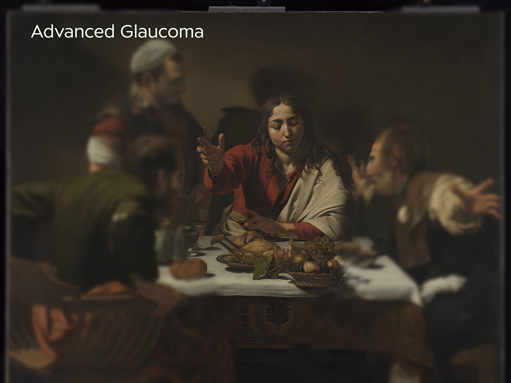 Michelangelo Merisi da Caravaggio The Supper at Emmaus advanced