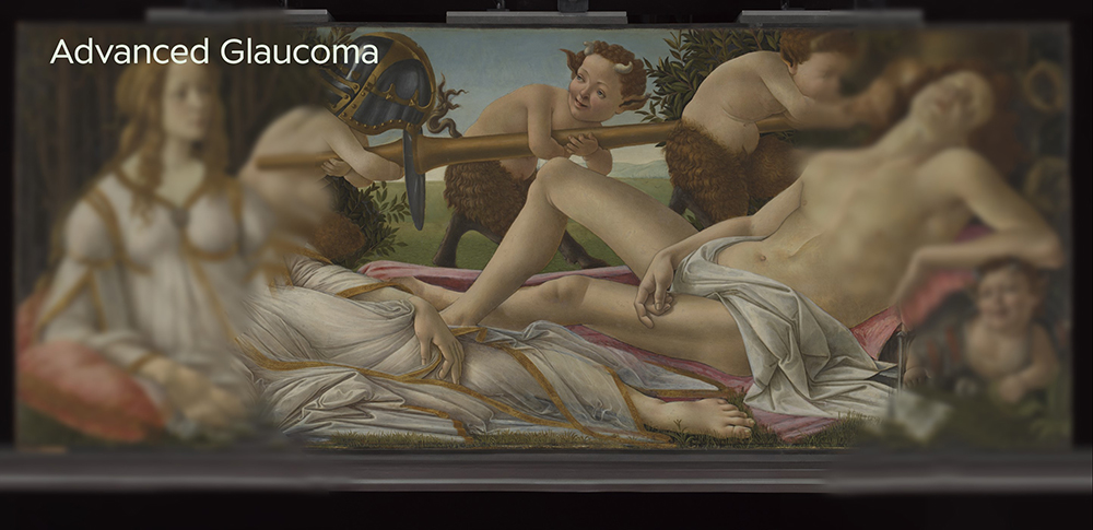 Sandro Botticelli Venus and Mars 1485 Advanced