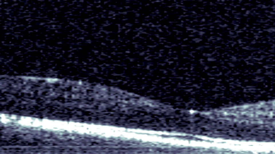 Image of the human retina captured using a Siloton Akepa photonic chip