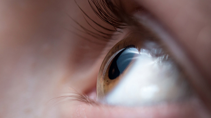 Closeup of eye