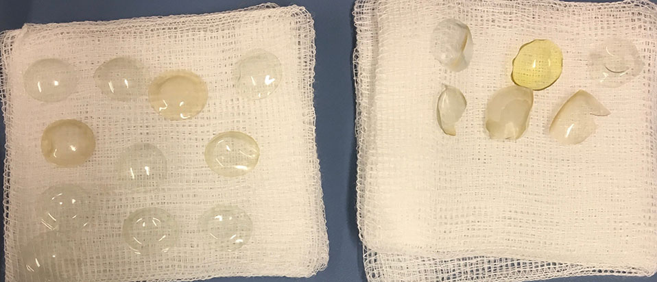 Contact lenses