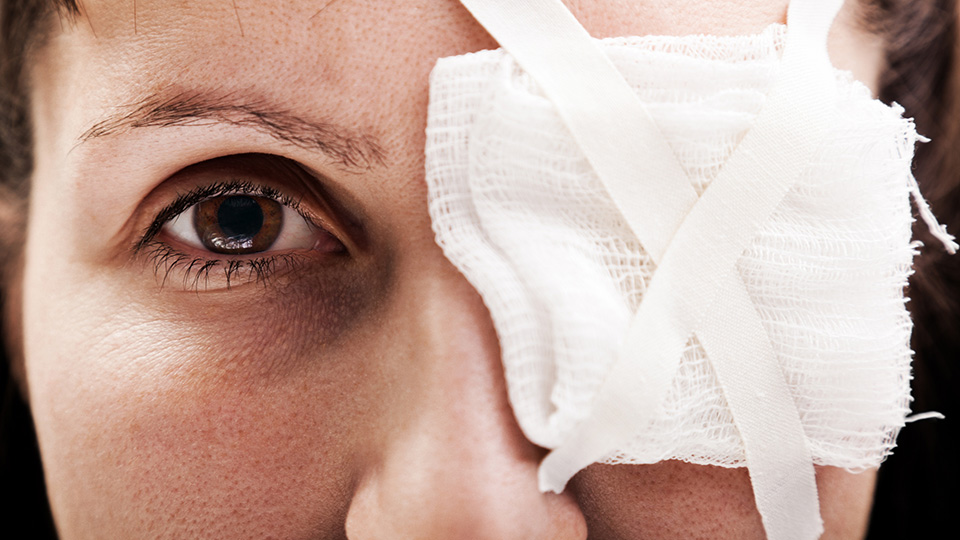 Eye with bandage