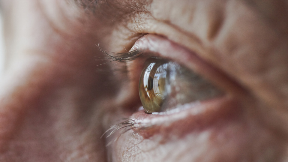 eye