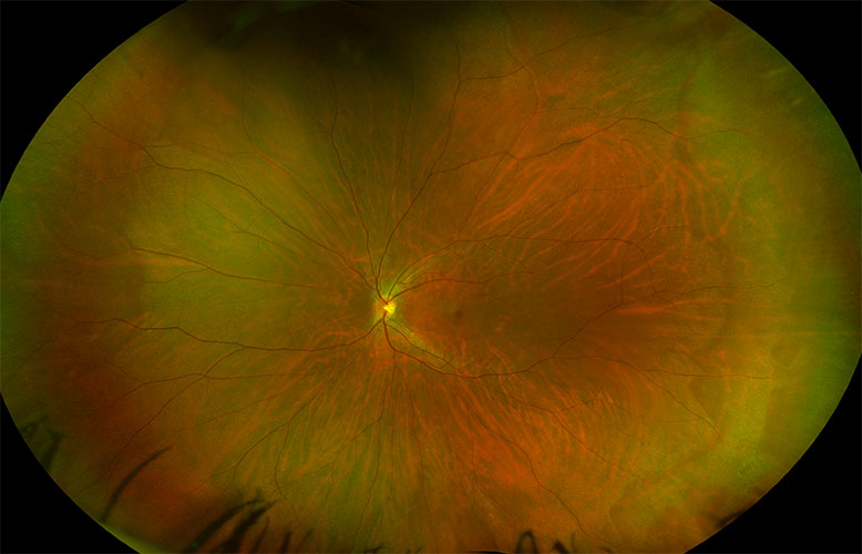 The move in optometry to adopt new technology is growing